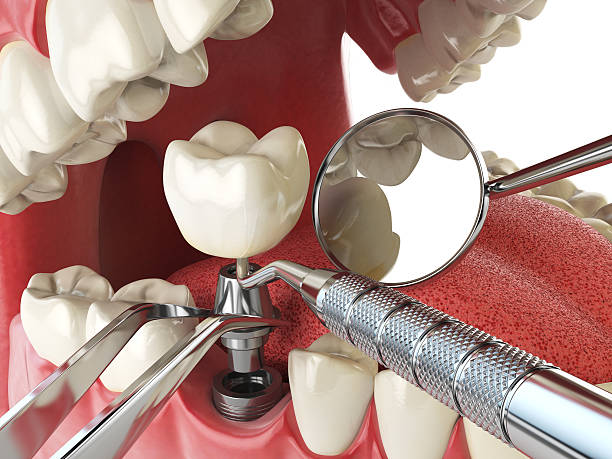 Best Cracked Tooth Emergency Dentist  in Hopewell, TN